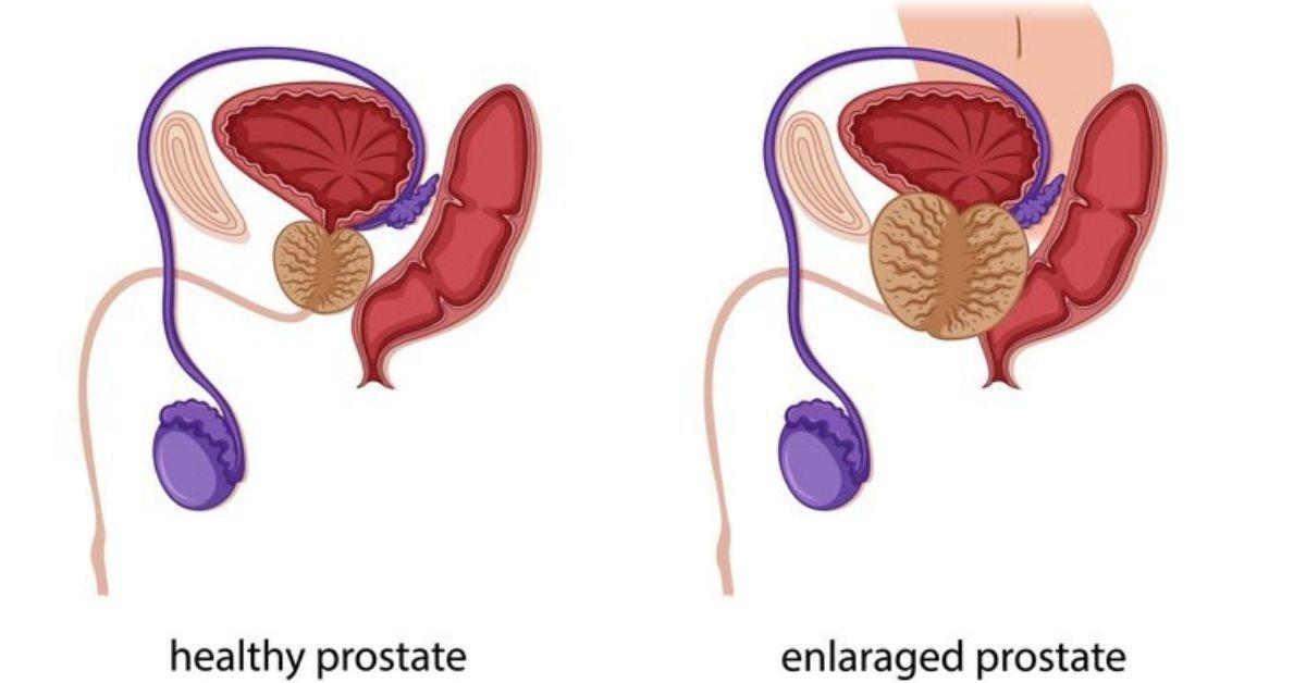 best urologist in Faridabad